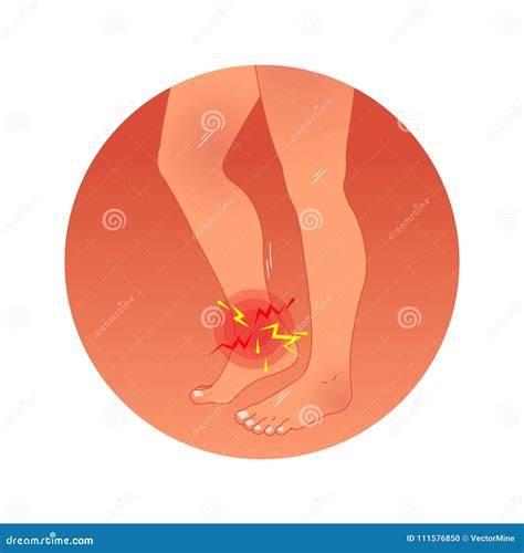 Painful Ankle Concept Vector Illustration With Human Legs Work
