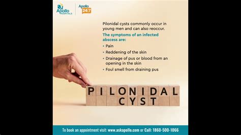 What Does A Pilonidal Cyst Look Like Apollo Hospitals Youtube