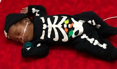 Photos Hospitalized Babies Dress Up For Nicu Halloween Costume Contest