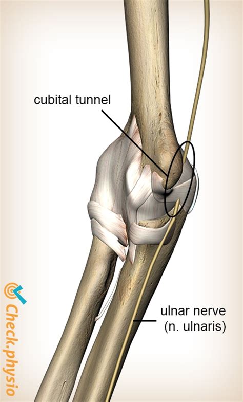 Cubital Tunnel Syndrome Physio Check