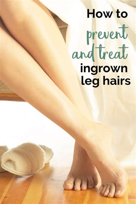 How To Treat And Prevent Ingrown Leg Hairs June 25 2019 Ingrown Hair