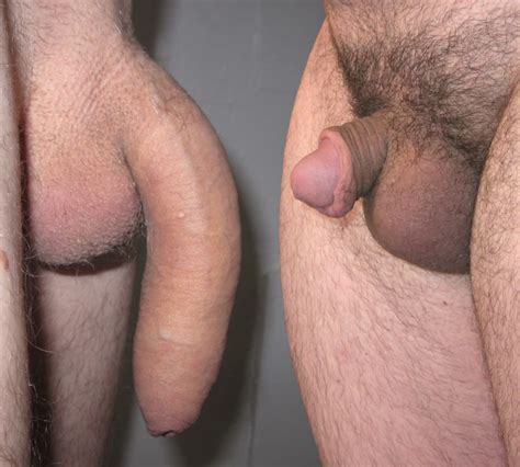 Cock Size Difference