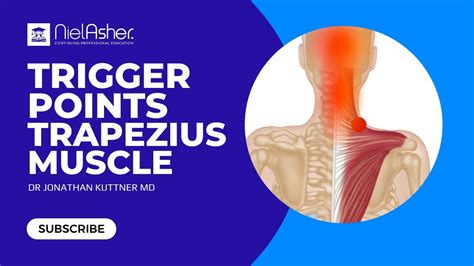 Trapezius How To Find Trigger Points Youtube