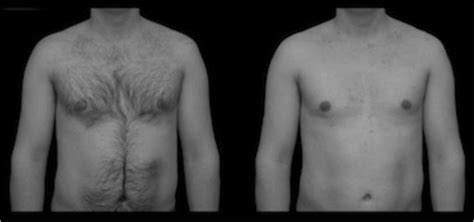 An Example Of The Body Hair Stimuli Used In This Study Images Show The Download Scientific