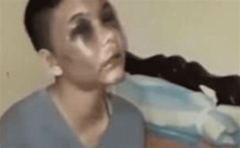 Mujer maltratada brutalmente era mordida y apuñalada