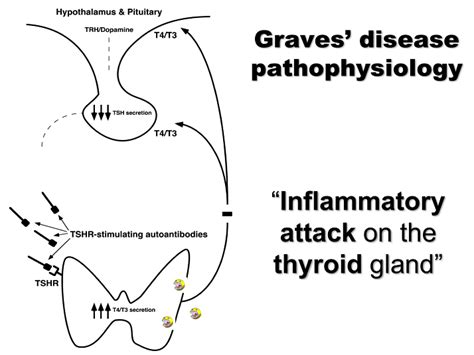 Graves Disease Pathophysiology Presentation Tsh Receptor Antibodies