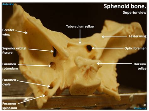Sphenoid Bone Superior View With Labels Axial Skeleton Flickr
