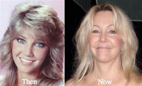 Heather Locklear Plastic Surgery Before And After Photos Latest