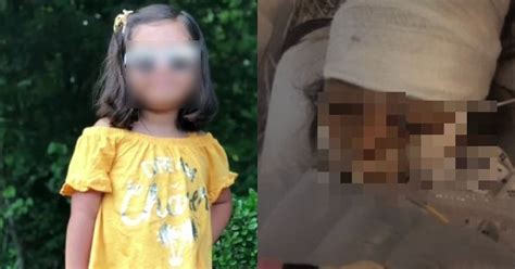 Budak 7 Tahun Dilaporkan Maut Selepas Koma And Bengkak Otak Jadi Mangsa