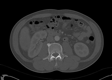 A Systematic Approach To The Interpretation Of Ct Abdomenpelvis