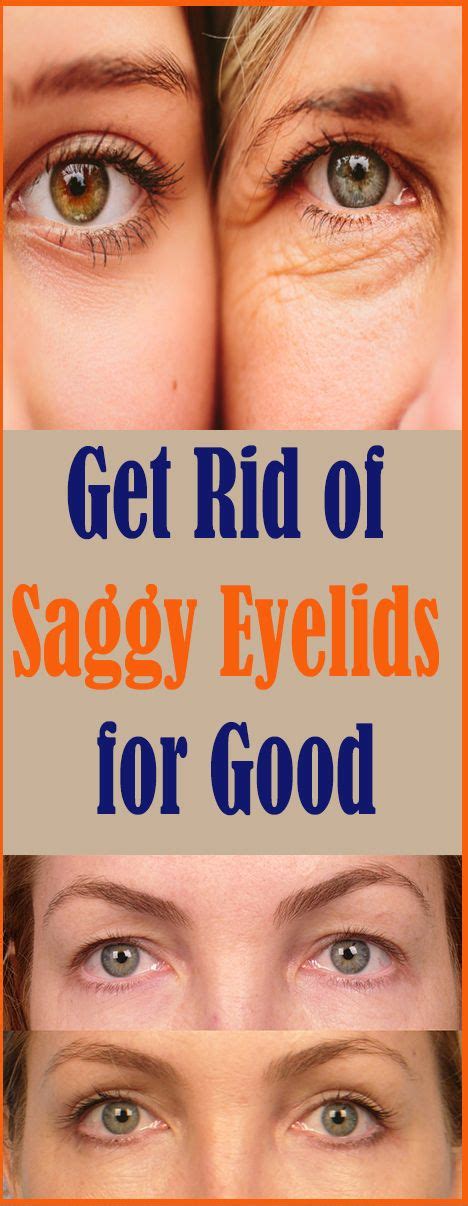 Get Rid Of Saggy Eyelids For Good With Images Saggy Eyelids Saggy