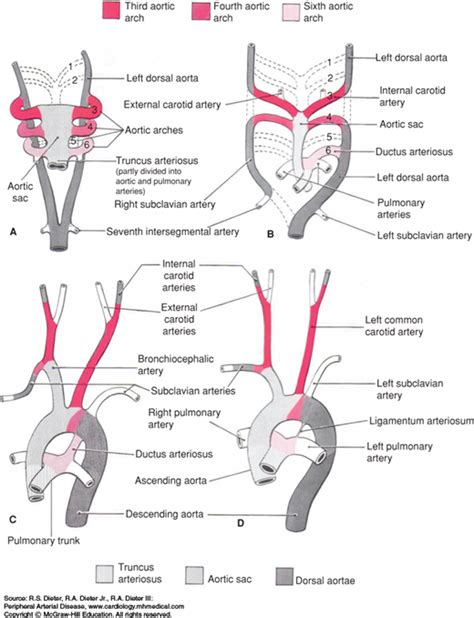 Nonembolic Disorders Of The Pulmonary Artery Peripheral Arterial