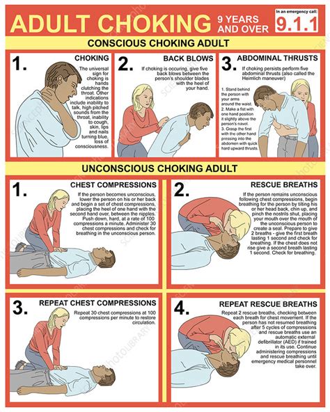 Choking First Aid Chart Illustration Stock Image C0276353