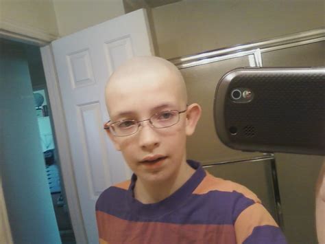 Living Stronger Balding At 13