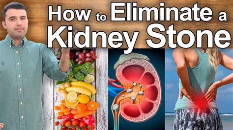 How To Eliminate Kidney Stones Natural Treatments For Kidney Stones