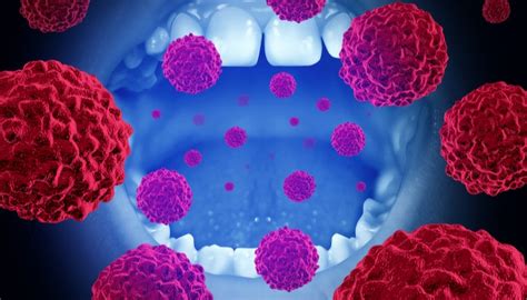 Dental Specialties Institute Inc Salivary Biomarkers For Detecting