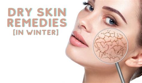 4 Natural Homemade Face Packs For Dry Skin In Winter Beautysutras