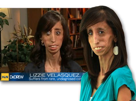 Lizzie Velasquez Answers Bullies Who Branded Her The Worlds Ugliest