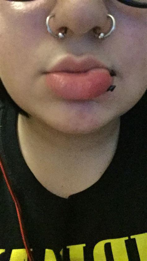 Help I Just Got My Lip Pierced And Its Swelling Is This Normal Or