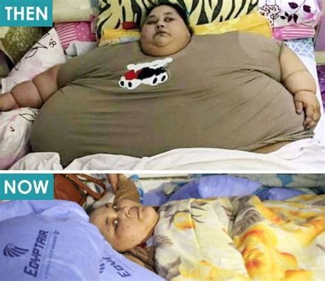 Worlds Fattest Woman Lost 5st In A Week Before Lifesaving Operation Metro News