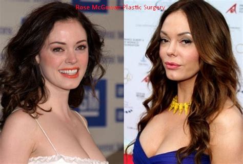 Updated Rose Mcgowan Plastic Surgery Before After 2022