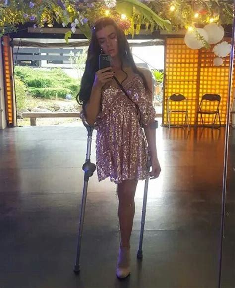 Leg Amputee Selfie Crutches Amputee Hips Selfie Women Places