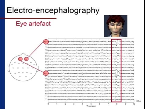 Artifacts In Eeg Recognition And Differentiation