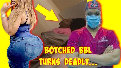 Botched Bbl😲 Black Woman Undergoes Plastic Surgery In Dominican Republic That Turns Deadly Youtube