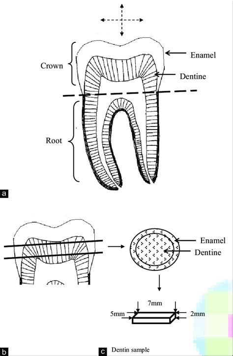 Molar Tooth Structure