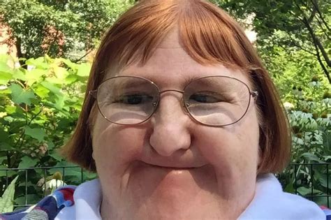 disabled blogger told she was too ugly for selfies keeps on posting photos in defiance
