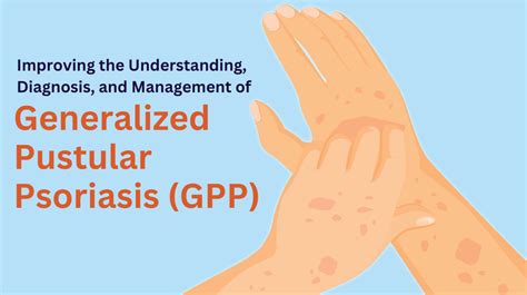 Improving The Understanding Diagnosis And Management Of Generalized