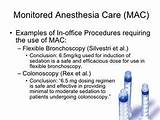 Pictures of Monitored Anesthesia Care