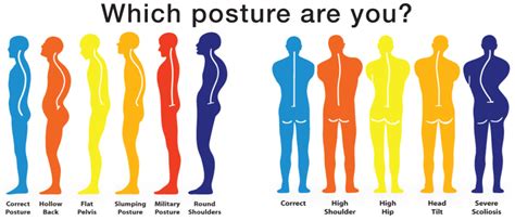 Look And Feel Better By Having Your Posture Corrected