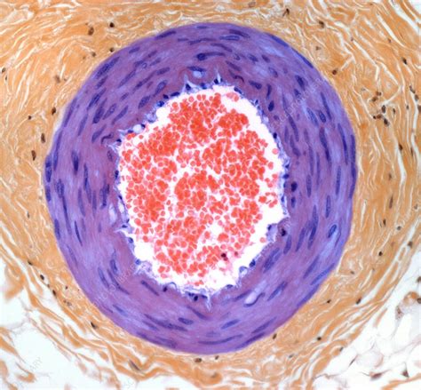 Arteriole Blood Vessel Light Micrograph Stock Image C0198018
