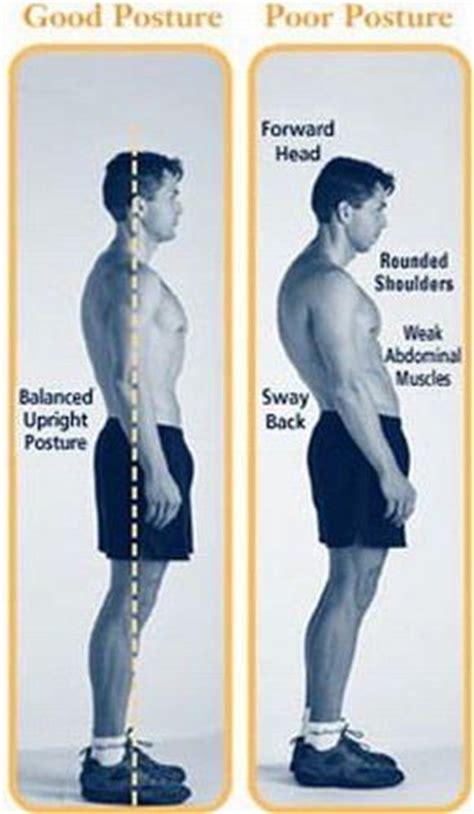 Swayback Posture And Therapy By Dr Jeffrey Tucker Dr Fuji Dms Deep