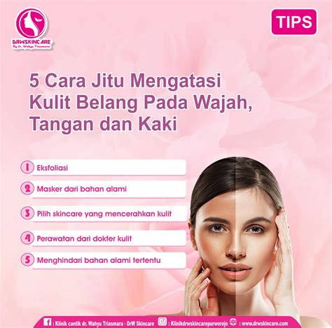 5 Cara Jitu Mengatasi Kulit Belang Pada Wajah Tangan Dan Kaki Drw