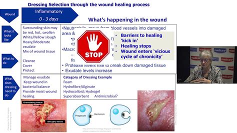 Types Of Wound Dressings Printable Chart