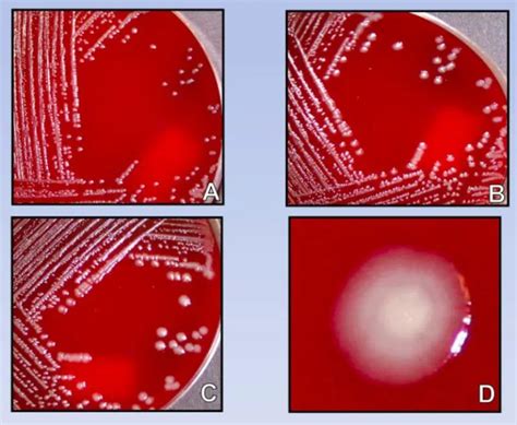 Yersinia Pestis Properties Disease Lab Diagnosis Microbe Online