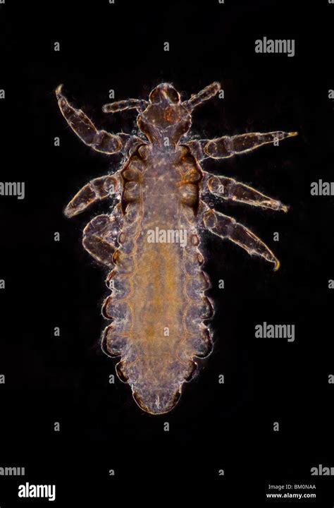 Head Louse Human Hair Hi Res Stock Photography And Images Alamy