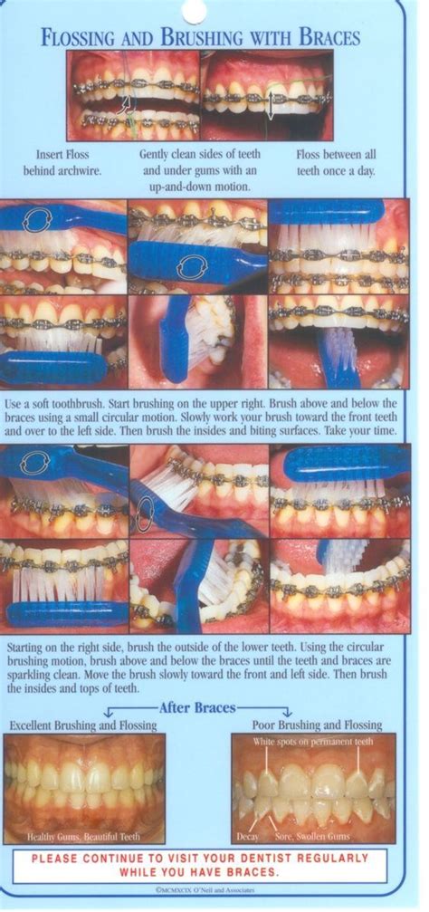 Tess Oral Health 820 Retainer Case Braces Tips Braces Food Dental Braces