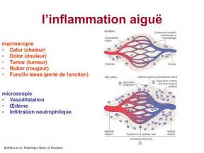 Ppt Réaction Inflammatoire Aigue Et Chronique Powerpoint Presentation