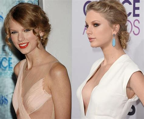 Taylor Swift Before And After Plastic Surgery Life To Star Bad Celebrity Plastic Surgery