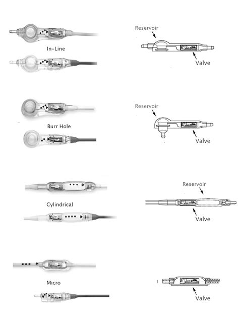 Codman Hakim Precision Pressure Differential Valves The Ispn Guide To