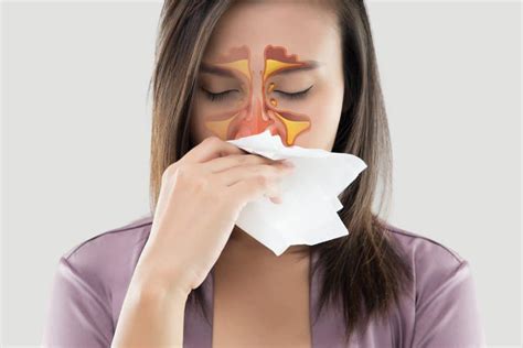 No Stuffy Noses Allowed Sinus Treatment From Excelent Of Birmingham Al