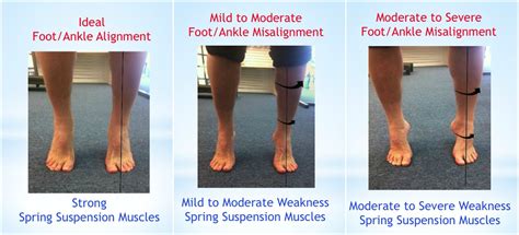 Video Tutorial 200 Can You Pass The Foot Ankle Toe Raise Alignment