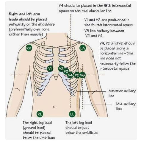 Pin By Christ Mas On Medical Heart And Veins Nursing School Emergency