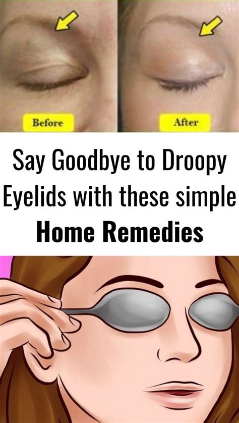 Crazy Hacks To Not Look Tired And Droopy Natural And Makeup Tips Droopy Eyelids Eye