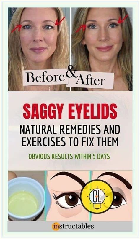 Natural Remedy For Sagging Eyelids You Will See Results In 2 Minutes
