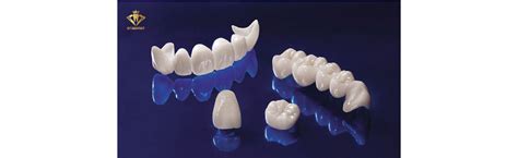 Răng Sứ Thẩm Mỹ Cắm Implant St Dentist Răng Toàn Sứ