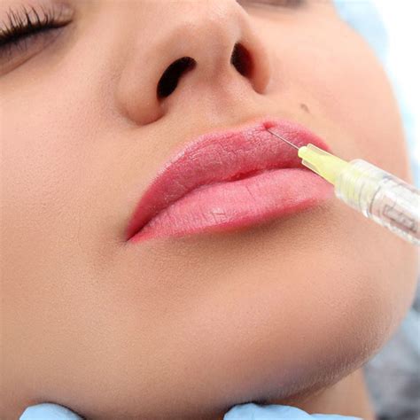 The treatment takes approximately 20 minutes and the injection(s) will be administered by an. Lip Filler Augmentation in Delhi - Pulastya Cadle